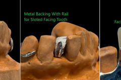 FacingToothLarge