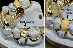 Half-Boxing-with-Tube-Tooth