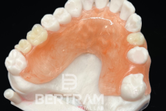 Flexi_Partial_2