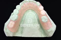 Flexi_Partial_3