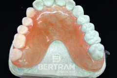 Flexi_Partial_4