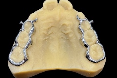 3d-printed-bands-3