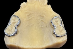 3d-printed-bands-5