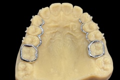 3d-printed-bands-6