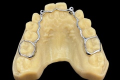 3d-printed-bands-7