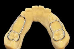Band-and-Loop-1