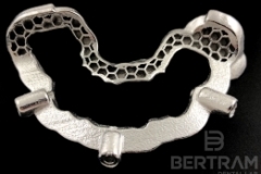 Surgical_Guide_3