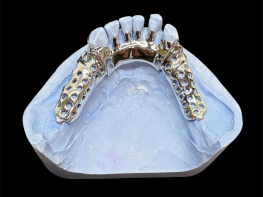 SLM partials